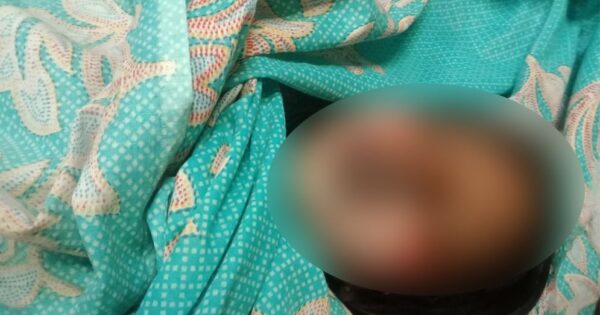 বরিশালের বাবুগঞ্জে কুপ্রস্তাবে রাজি না হওয়ায় কিশোরীর গায়ে আগুন দিয়ে হত্যা